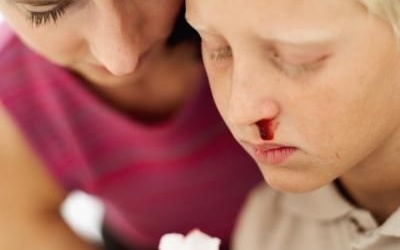 Vì sao trẻ bị chảy máu cam?