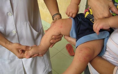 Phú Yên: Bệnh sốt xuất huyết diễn biến phức tạp