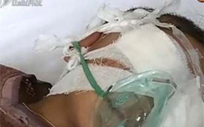 Trung Quốc: Nghi phạm móc mắt bé trai là bác dâu