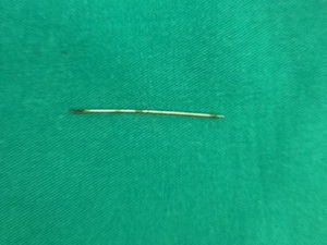 Cứu sống bệnh nhân bị kim đâm vào tim