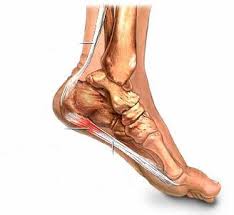 Đau gót chân - nghĩ ngay đến yếu thận