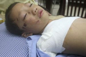 Bé 5 tuổi bị gấu nuôi cắn nát 2 tay