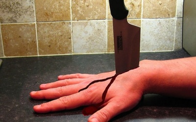 Phát hiện gene 'không biết đau'