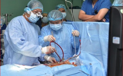 BV E triển khai thường quy mổ nội soi thay van tim 2 lá