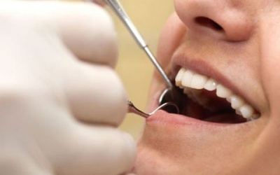 Bệnh nướu răng liên quan viêm khớp