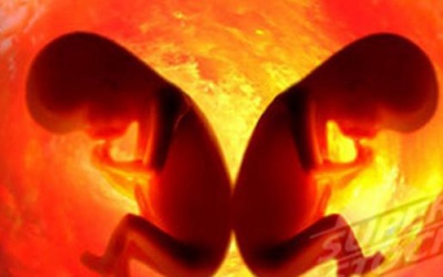 Phát hiện thai nhi trong dạ dày cậu bé 4 tuổi