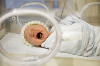 Chất ngọt bảo vệ não của trẻ sinh non