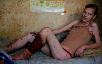 Ma túy 'ăn thịt người' kinh khủng nhất thế giới