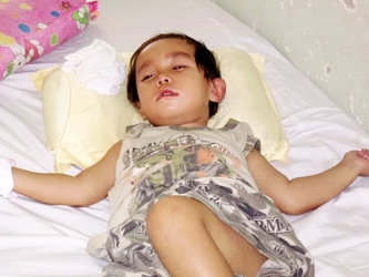 Mù, liệt sau khi mổ thoát vị bẹn