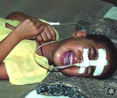 Viêm não Nhật Bản - Không nên lo lắng quá mức