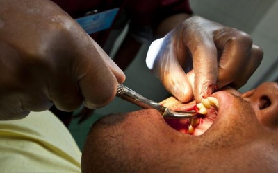 Tử vong vì nhiễm trùng răng