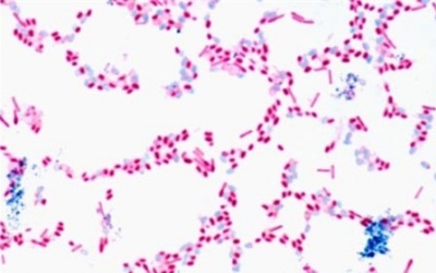 Chất cực độc bị giới khoa học che giấu 40 năm