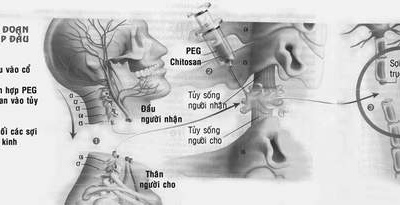 Ghép đầu - Quái dị hay hy vọng mới?