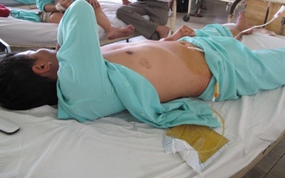 Nối thành công 'của quý' bị cắt đứt