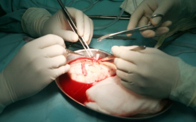 Vụ bị cắt nhầm 2 quả thận: Không thống nhất được mức bồi thường