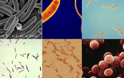 70% vi khuẩn gây nhiễm khuẩn BV kháng lại ít nhất 1 loại kháng sinh thông dụng