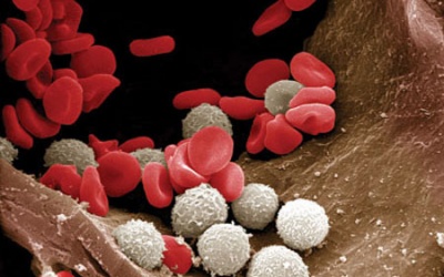 Iclusig chữa bạch cầu có thể làm tăng cục máu đông