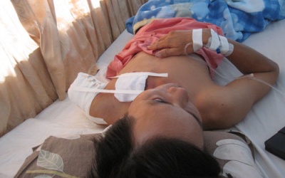 Thời gian 'vàng' để nối chi đứt lìa: trong vòng 6 tiếng sau tai nạn