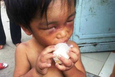 Giải cứu cháu bé ba tuổi bị bạo hành, ngược đãi