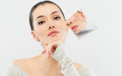 Nói không với mụn!