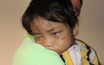 'Địa ngục trần gian' của cậu bé 3 tuổi bị bắt đi ăn xin