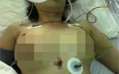 TP.HCM chấn chỉnh hoạt động các cơ sở phẫu thuật thẩm mỹ