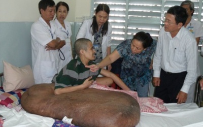 Bệnh nhân Duy Hải tử vong do 'tắc nghẽn mạch phổi'?