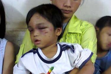 Vụ bé ba tuổi bị cậu đánh tàn nhẫn: Chỉ có thể cảnh cáo?