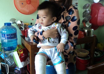 Dừng hoạt động cơ sở giữ trẻ làm bé gãy hai chân