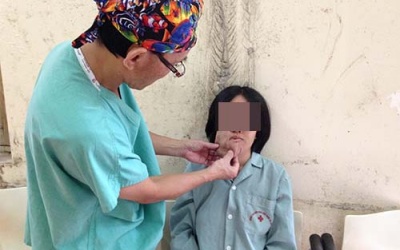 'Trả lại' khuôn mặt biến dạng gần 20 năm vì u xơ thần kinh