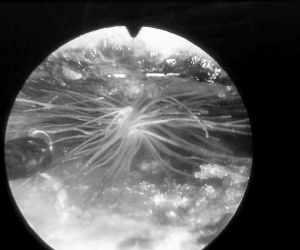 Bồ công anh nở hoa... trong tai bé một tuổi