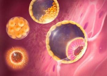 Chửa trứng và biến chứng ung thư nhau thai