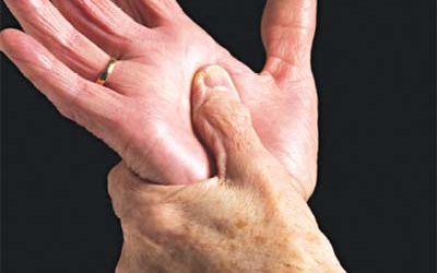 Hy vọng mới cho bệnh nhân viêm khớp dạng thấp