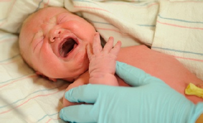 Hệ miễn dịch của trẻ sinh mổ kém hơn trẻ sinh thường