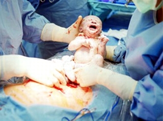 Một sản phụ được mổ cấp cứu tại nhà