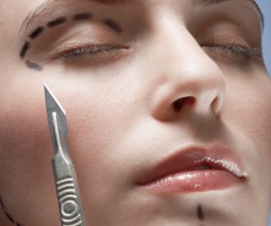 Những điều cần biết trước khi 'đụng dao kéo”