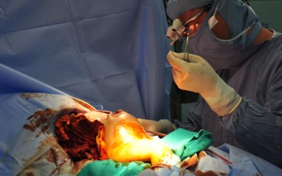 Đóng thành ngực cho bé Phi Phụng