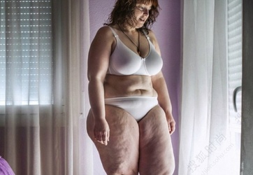 Hành trình giảm béo của cô gái 124 kg