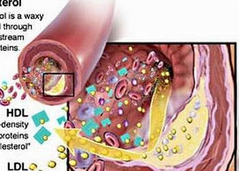 Tầm soát và khám miễn phí bệnh rối loạn lipid - máu