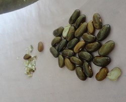 Y tá nhầm đậu là Vitamin bị thôi việc