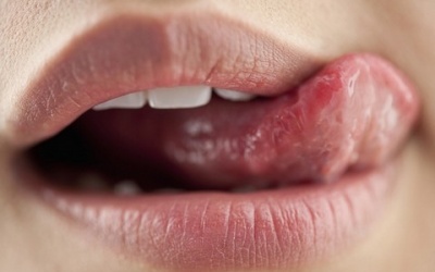 Mẹo nhỏ giúp môi hết khô nẻ