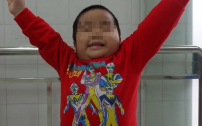 Tránh tai biến khiến trẻ liệt cánh tay sau sinh