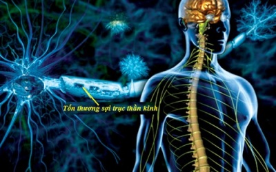 Thần kinh - yếu điểm của người bệnh đái tháo đường?