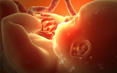 Kỳ lạ mẹ dùng thuốc phá thai, thai nhi vẫn phát triển