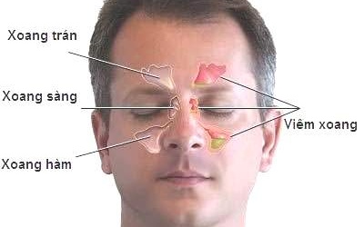 Thuốc điều trị viêm mũi xoang