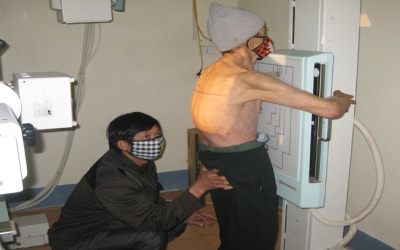 Điều trị bệnh lao kháng thuốc bằng tế bào gốc tủy xương