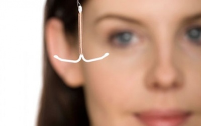 Tại sao đặt vòng rồi vẫn có thai?