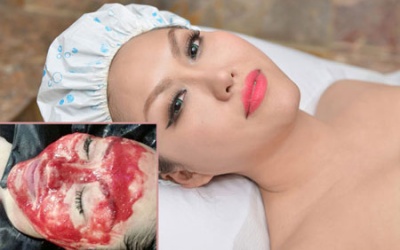 Phi Thanh Vân làm đẹp bằng... máu