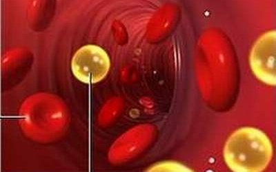 Rối loạn lipid máu: Ăn gì?