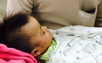 Yên Bái: Dịch sởi lan rộng ở vùng núi